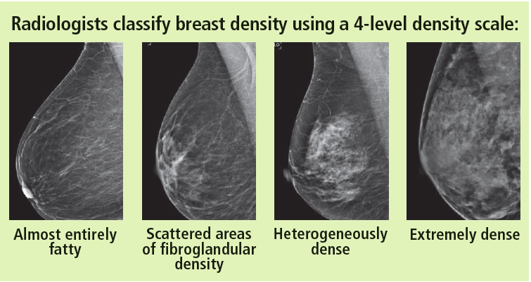 What Is Breast Density How Does It Affect Cancer Screening   Breast Density 